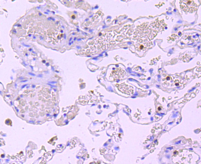 Immunohistochemical analysis of paraffin-embedded human lung tissue using anti-Myeloperoxidase antibody. The section was pre-treated using heat mediated antigen retrieval with Tris-EDTA buffer (pH 8.0-8.4) for 20 minutes.The tissues were blocked in 5% BSA for 30 minutes at room temperature, washed with ddH2O and PBS, and then probed with the primary antibody (ET1703-21, 1/50) for 30 minutes at room temperature. The detection was performed using an HRP conjugated compact polymer system. DAB was used as the chromogen. Tissues were counterstained with hematoxylin and mounted with DPX.