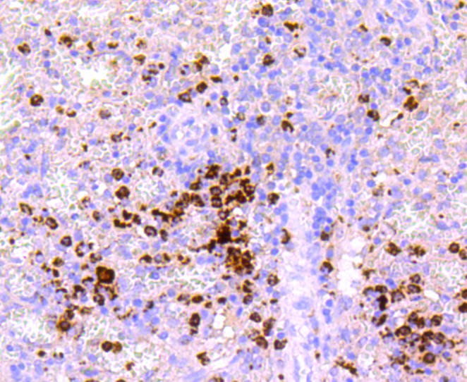 Immunohistochemical analysis of paraffin-embedded human spleen tissue using anti-Myeloperoxidase antibody. The section was pre-treated using heat mediated antigen retrieval with Tris-EDTA buffer (pH 8.0-8.4) for 20 minutes.The tissues were blocked in 5% BSA for 30 minutes at room temperature, washed with ddH2O and PBS, and then probed with the primary antibody (ET1703-21, 1/50) for 30 minutes at room temperature. The detection was performed using an HRP conjugated compact polymer system. DAB was used as the chromogen. Tissues were counterstained with hematoxylin and mounted with DPX.