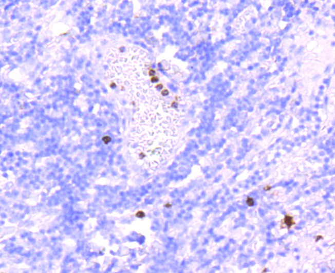 Immunohistochemical analysis of paraffin-embedded human tonsil tissue using anti-Myeloperoxidase antibody. The section was pre-treated using heat mediated antigen retrieval with Tris-EDTA buffer (pH 8.0-8.4) for 20 minutes.The tissues were blocked in 5% BSA for 30 minutes at room temperature, washed with ddH2O and PBS, and then probed with the primary antibody (ET1703-21, 1/50) for 30 minutes at room temperature. The detection was performed using an HRP conjugated compact polymer system. DAB was used as the chromogen. Tissues were counterstained with hematoxylin and mounted with DPX.