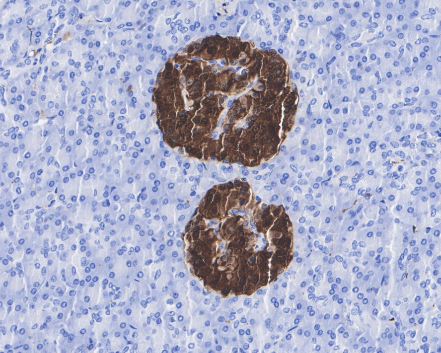 ICC staining of PGP9.5 in PC-12 cells (red). Formalin fixed cells were permeabilized with 0.1% Triton X-100 in TBS for 10 minutes at room temperature and blocked with 1% Blocker BSA for 15 minutes at room temperature. Cells were probed with the primary antibody (ET1703-22, 1/50) for 1 hour at room temperature, washed with PBS. Alexa Fluor®594 Goat anti-Rabbit IgG was used as the secondary antibody at 1/1,000 dilution. The nuclear counter stain is DAPI (blue).