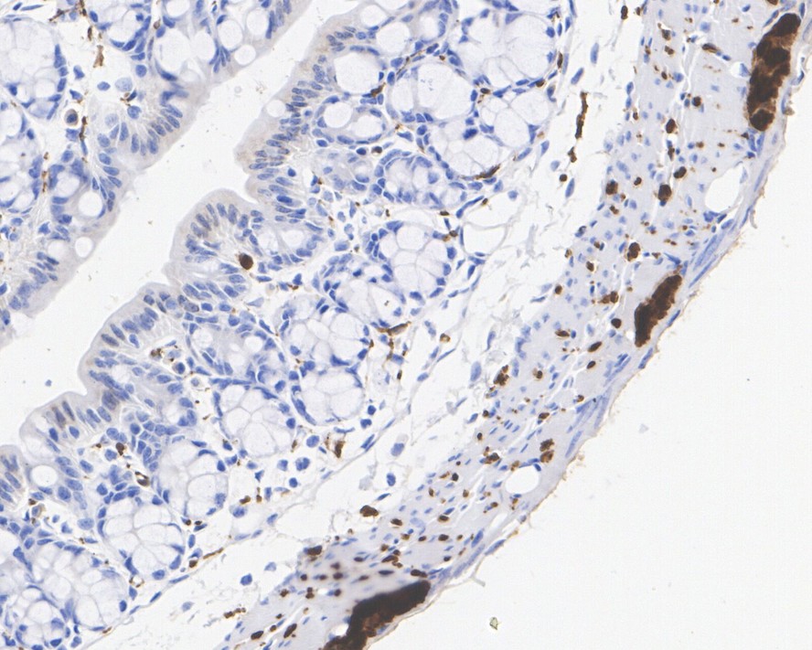Immunohistochemical analysis of paraffin-embedded human pancreas tissue with Rabbit anti-PGP9.5 antibody (ET1703-22) at 1/1,000 dilution.<br />
<br />
The section was pre-treated using heat mediated antigen retrieval with Tris-EDTA buffer (pH 9.0) for 20 minutes. The tissues were blocked in 1% BSA for 20 minutes at room temperature, washed with ddH2O and PBS, and then probed with the primary antibody (ET1703-22) at 1/1,000 dilution for 1 hour at room temperature. The detection was performed using an HRP conjugated compact polymer system. DAB was used as the chromogen. Tissues were counterstained with hematoxylin and mounted with DPX.