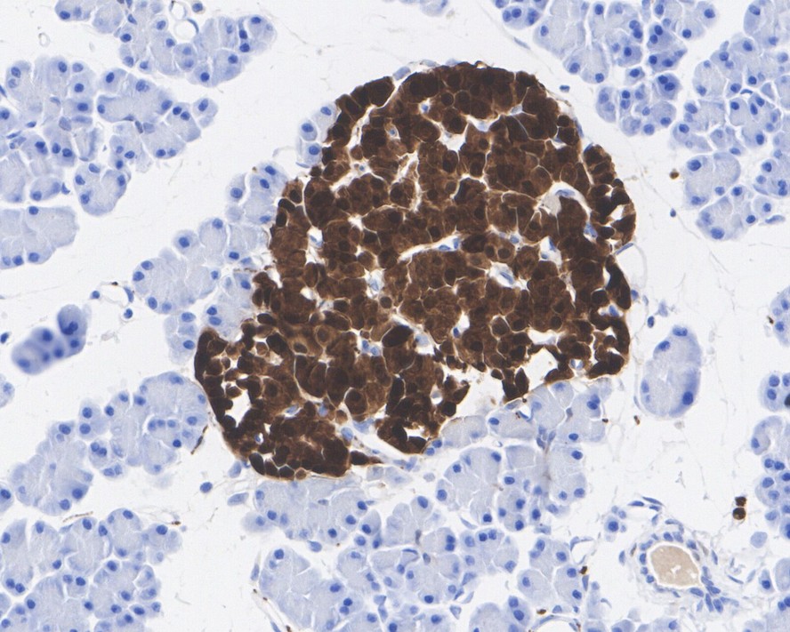 Immunohistochemical analysis of paraffin-embedded mouse spinal cord tissue using anti-PGP9.5 antibody. The section was pre-treated using heat mediated antigen retrieval with Tris-EDTA buffer (pH 8.0-8.4) for 20 minutes.The tissues were blocked in 5% BSA for 30 minutes at room temperature, washed with ddH2O and PBS, and then probed with the primary antibody (ET1703-22, 1/50) for 30 minutes at room temperature. The detection was performed using an HRP conjugated compact polymer system. DAB was used as the chromogen. Tissues were counterstained with hematoxylin and mounted with DPX.