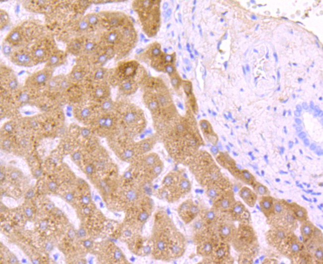 Immunohistochemical analysis of paraffin-embedded human liver tissue using anti-Haptoglobin antibody. The section was pre-treated using heat mediated antigen retrieval with Tris-EDTA buffer (pH 8.0-8.4) for 20 minutes.The tissues were blocked in 5% BSA for 30 minutes at room temperature, washed with ddH2O and PBS, and then probed with the primary antibody (ET1703-24, 1/50) for 30 minutes at room temperature. The detection was performed using an HRP conjugated compact polymer system. DAB was used as the chromogen. Tissues were counterstained with hematoxylin and mounted with DPX.