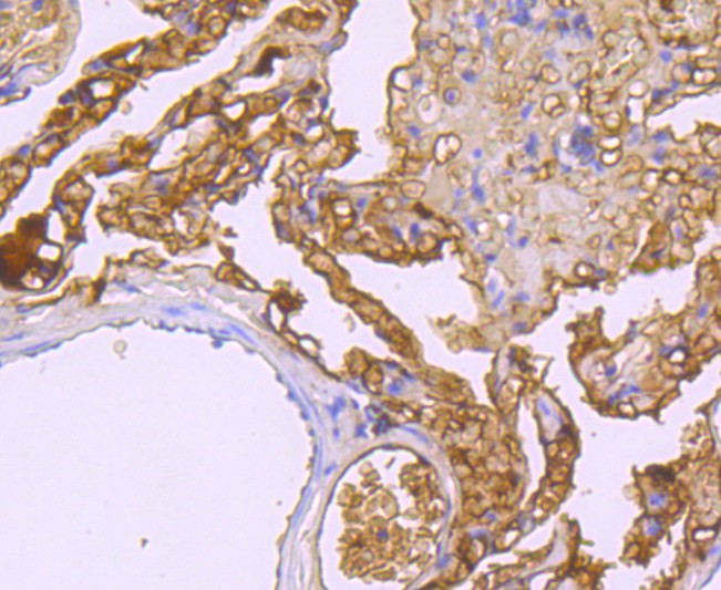 Immunohistochemical analysis of paraffin-embedded human lung tissue using anti-Haptoglobin antibody. The section was pre-treated using heat mediated antigen retrieval with Tris-EDTA buffer (pH 8.0-8.4) for 20 minutes.The tissues were blocked in 5% BSA for 30 minutes at room temperature, washed with ddH2O and PBS, and then probed with the primary antibody (ET1703-24, 1/50) for 30 minutes at room temperature. The detection was performed using an HRP conjugated compact polymer system. DAB was used as the chromogen. Tissues were counterstained with hematoxylin and mounted with DPX.