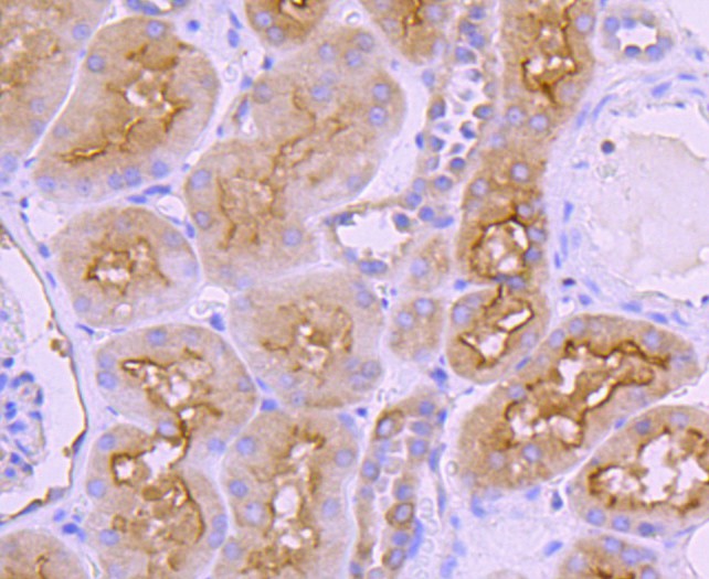 Immunohistochemical analysis of paraffin-embedded human kidney tissue using anti-Ezrin antibody. The section was pre-treated using heat mediated antigen retrieval with Tris-EDTA buffer (pH 8.0-8.4) for 20 minutes.The tissues were blocked in 5% BSA for 30 minutes at room temperature, washed with ddH2O and PBS, and then probed with the primary antibody (ET1703-25, 1/50) for 30 minutes at room temperature. The detection was performed using an HRP conjugated compact polymer system. DAB was used as the chromogen. Tissues were counterstained with hematoxylin and mounted with DPX.