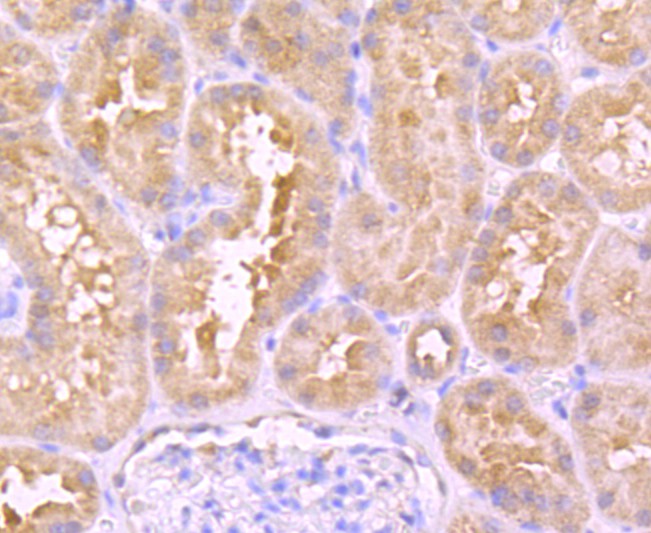 Immunohistochemical analysis of paraffin-embedded human kidney tissue using anti-Urokinase antibody. The section was pre-treated using heat mediated antigen retrieval with Tris-EDTA buffer (pH 8.0-8.4) for 20 minutes.The tissues were blocked in 5% BSA for 30 minutes at room temperature, washed with ddH2O and PBS, and then probed with the primary antibody (ET1703-26, 1/50) for 30 minutes at room temperature. The detection was performed using an HRP conjugated compact polymer system. DAB was used as the chromogen. Tissues were counterstained with hematoxylin and mounted with DPX.