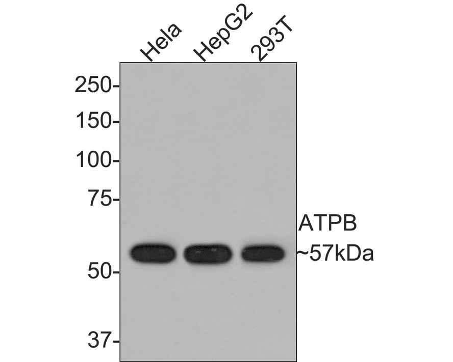 Western blot analysis of ATPB on different lysates with Rabbit anti-ATPB antibody (ET1703-29) at 1/1,000 dilution.<br />
<br />
Lane 1: Hela cell lysate<br />
Lane 2: HepG2 cell lysate<br />
Lane 3: 293T cell lysate<br />
<br />
Lysates/proteins at 10 µg/Lane.<br />
<br />
Predicted band size: 57 kDa<br />
Observed band size: 57 kDa<br />
<br />
Exposure time: 2 minutes;<br />
<br />
8% SDS-PAGE gel.<br />
<br />
Proteins were transferred to a PVDF membrane and blocked with 5% NFDM/TBST for 1 hour at room temperature. The primary antibody (ET1703-29) at 1/1,000 dilution was used in 5% NFDM/TBST at room temperature for 2 hours. Goat Anti-Rabbit IgG - HRP Secondary Antibody (HA1001) at 1:300,000 dilution was used for 1 hour at room temperature.