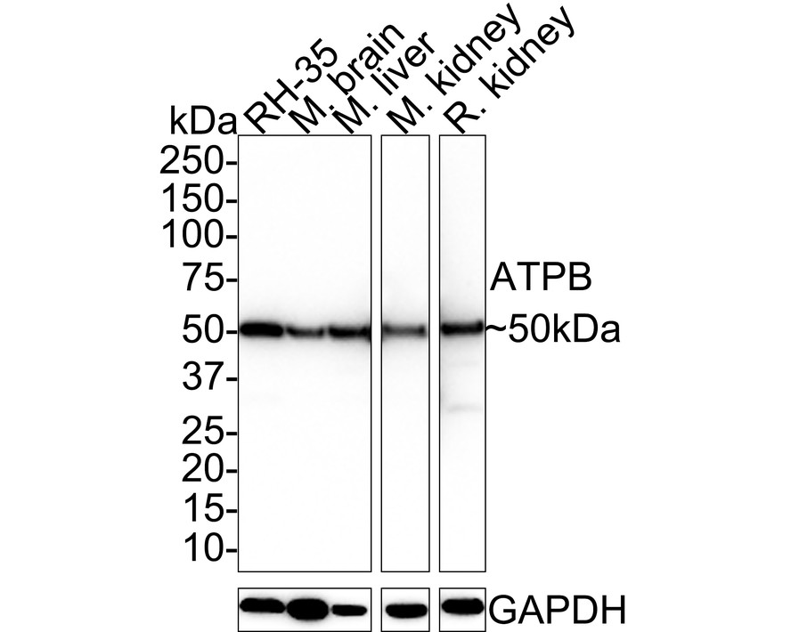 Western blot analysis of ATPB on zebrafish tissue lysates. Proteins were transferred to a PVDF membrane and blocked with 5% BSA in PBS for 1 hour at room temperature. The primary antibody (ET1703-29, 1/500) was used in 5% BSA at room temperature for 2 hours. Goat Anti-Rabbit IgG - HRP Secondary Antibody (HA1001) at 1:40,000 dilution was used for 1 hour at room temperature.