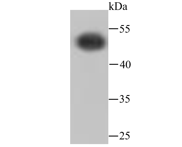 ICC staining of ATPB in 293T cells (red). Formalin fixed cells were permeabilized with 0.1% Triton X-100 in TBS for 10 minutes at room temperature and blocked with 10% negative goat serum for 15 minutes at room temperature. Cells were probed with the primary antibody (ET1703-29, 1/50) for 1 hour at room temperature, washed with PBS. Alexa Fluor®594 conjugate-Goat anti-Rabbit IgG was used as the secondary antibody at 1/1,000 dilution. The nuclear counter stain is DAPI (blue).