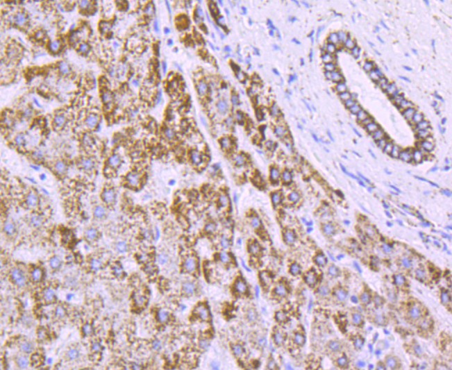 Immunohistochemical analysis of paraffin-embedded human liver tissue using anti-ATPB antibody. The section was pre-treated using heat mediated antigen retrieval with Tris-EDTA buffer (pH 9.0) for 20 minutes.The tissues were blocked in 5% BSA for 30 minutes at room temperature, washed with ddH2O and PBS, and then probed with the primary antibody (ET1703-29, 1/50) for 30 minutes at room temperature. The detection was performed using an HRP conjugated compact polymer system. DAB was used as the chromogen. Tissues were counterstained with hematoxylin and mounted with DPX.