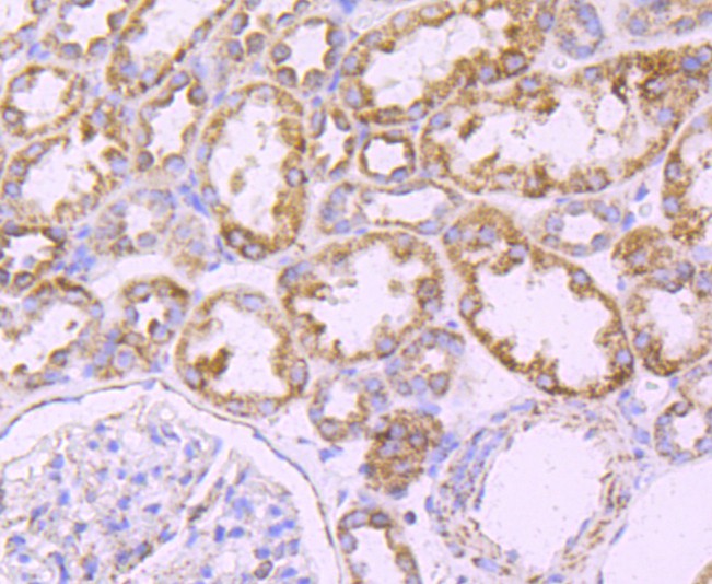 Immunohistochemical analysis of paraffin-embedded human kidney tissue using anti-ATPB antibody. The section was pre-treated using heat mediated antigen retrieval with Tris-EDTA buffer (pH 9.0) for 20 minutes.The tissues were blocked in 5% BSA for 30 minutes at room temperature, washed with ddH2O and PBS, and then probed with the primary antibody (ET1703-29, 1/50) for 30 minutes at room temperature. The detection was performed using an HRP conjugated compact polymer system. DAB was used as the chromogen. Tissues were counterstained with hematoxylin and mounted with DPX.