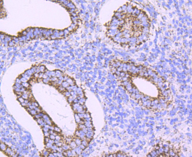 Immunohistochemical analysis of paraffin-embedded human uterus tissue using anti-ATPB antibody. The section was pre-treated using heat mediated antigen retrieval with Tris-EDTA buffer (pH 9.0) for 20 minutes.The tissues were blocked in 5% BSA for 30 minutes at room temperature, washed with ddH2O and PBS, and then probed with the primary antibody (ET1703-29, 1/50) for 30 minutes at room temperature. The detection was performed using an HRP conjugated compact polymer system. DAB was used as the chromogen. Tissues were counterstained with hematoxylin and mounted with DPX.