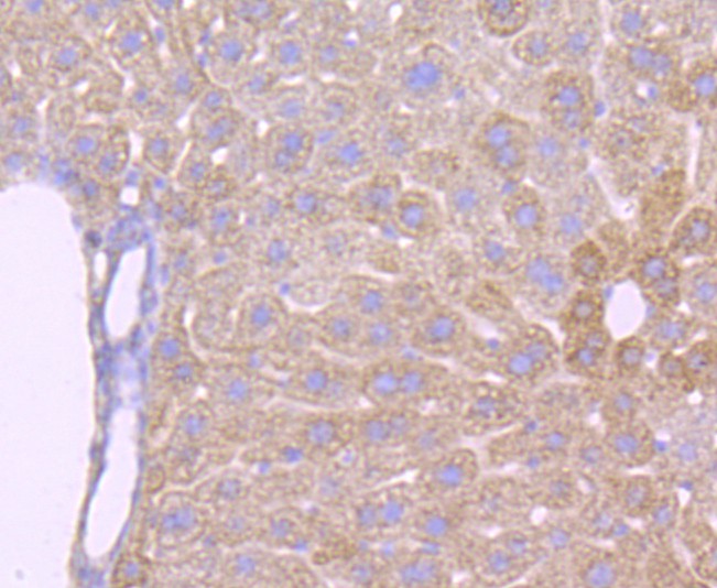 Immunohistochemical analysis of paraffin-embedded mouse brain tissue using anti-ATPB antibody. The section was pre-treated using heat mediated antigen retrieval with Tris-EDTA buffer (pH 9.0) for 20 minutes.The tissues were blocked in 5% BSA for 30 minutes at room temperature, washed with ddH2O and PBS, and then probed with the primary antibody (ET1703-29, 1/50) for 30 minutes at room temperature. The detection was performed using an HRP conjugated compact polymer system. DAB was used as the chromogen. Tissues were counterstained with hematoxylin and mounted with DPX.