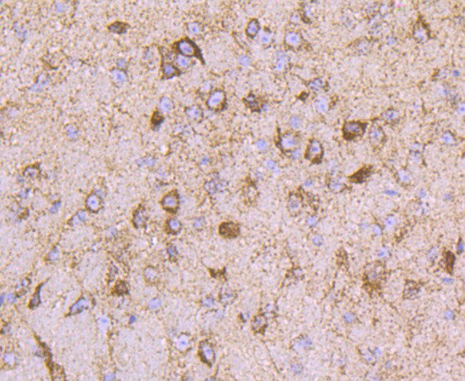 Immunohistochemical analysis of paraffin-embedded mouse brain tissue using anti-ATPB antibody. The section was pre-treated using heat mediated antigen retrieval with Tris-EDTA buffer (pH 9.0) for 20 minutes.The tissues were blocked in 5% BSA for 30 minutes at room temperature, washed with ddH2O and PBS, and then probed with the primary antibody (ET1703-29, 1/50) for 30 minutes at room temperature. The detection was performed using an HRP conjugated compact polymer system. DAB was used as the chromogen. Tissues were counterstained with hematoxylin and mounted with DPX.