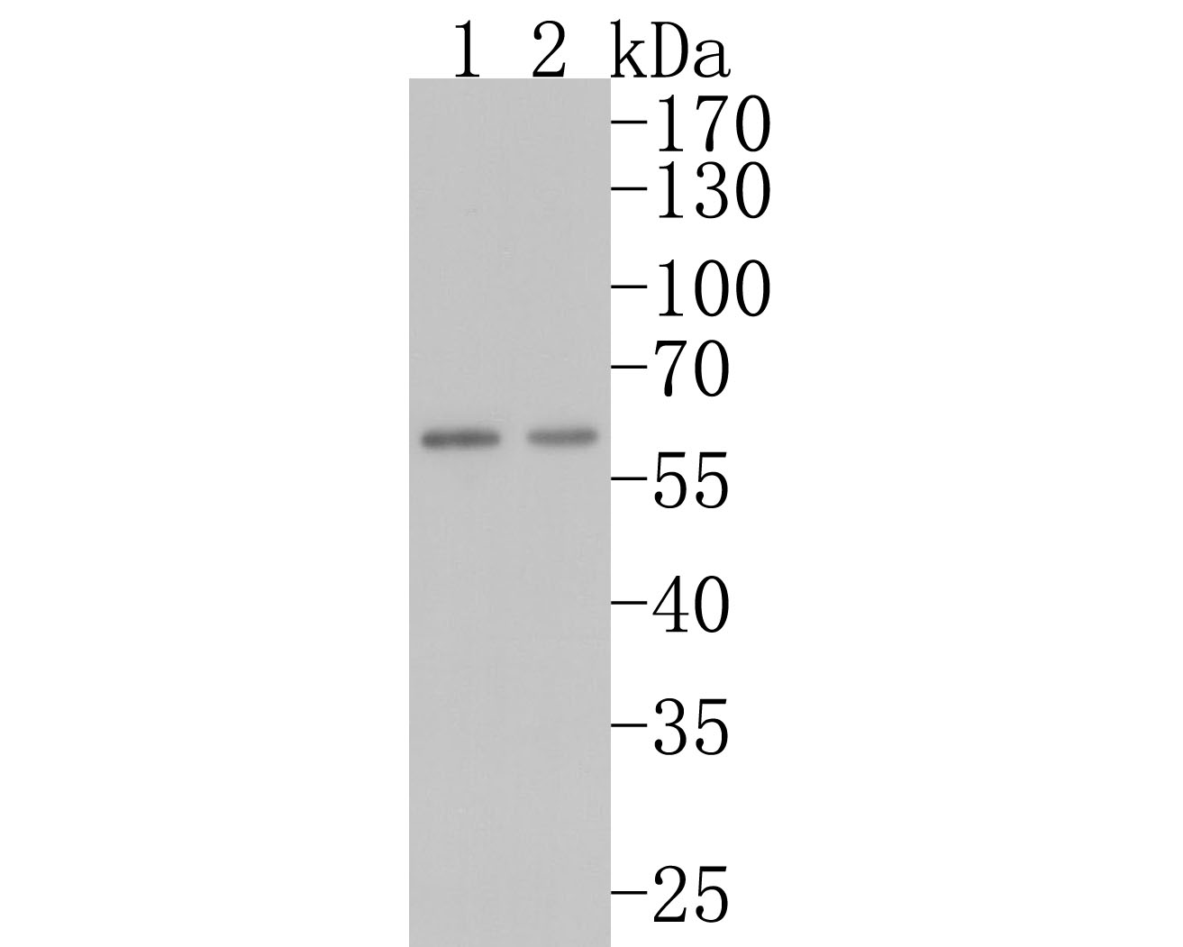 Western blot analysis of Catalase on different lysates. Proteins were transferred to a PVDF membrane and blocked with 5% BSA in PBS for 1 hour at room temperature. The primary antibody (ET1703-31, 1/500) was used in 5% BSA at room temperature for 2 hours. Goat Anti-Rabbit IgG - HRP Secondary Antibody (HA1001) at 1:200,000 dilution was used for 1 hour at room temperature.<br />
Positive control: <br />
Lane 1: Hela cell lysate<br />
Lane 2: HepG2 cell lysate