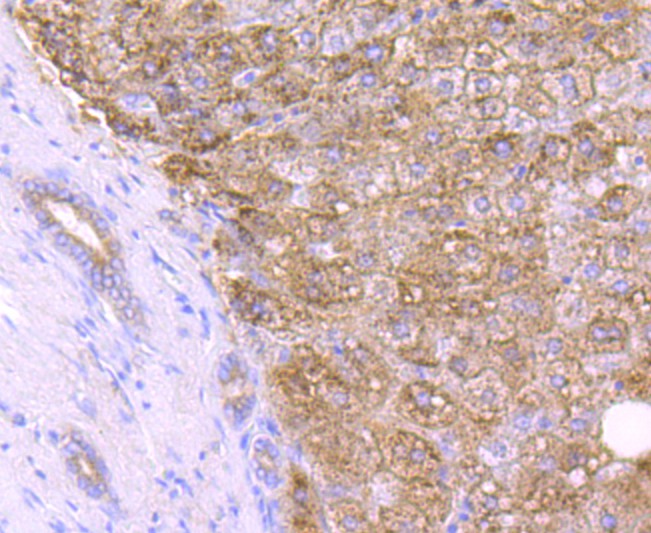 Immunohistochemical analysis of paraffin-embedded human liver tissue using anti-Catalase antibody. The section was pre-treated using heat mediated antigen retrieval with Tris-EDTA buffer (pH 9.0) for 20 minutes.The tissues were blocked in 1% BSA for 30 minutes at room temperature, washed with ddH2O and PBS, and then probed with the primary antibody (ET1703-31, 1/50) for 30 minutes at room temperature. The detection was performed using an HRP conjugated compact polymer system. DAB was used as the chromogen. Tissues were counterstained with hematoxylin and mounted with DPX.