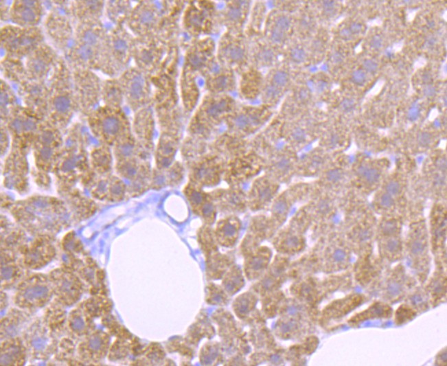 Immunohistochemical analysis of paraffin-embedded mouse liver tissue using anti-Catalase antibody. The section was pre-treated using heat mediated antigen retrieval with Tris-EDTA buffer (pH 9.0) for 20 minutes.The tissues were blocked in 1% BSA for 30 minutes at room temperature, washed with ddH2O and PBS, and then probed with the primary antibody (ET1703-31, 1/50) for 30 minutes at room temperature. The detection was performed using an HRP conjugated compact polymer system. DAB was used as the chromogen. Tissues were counterstained with hematoxylin and mounted with DPX.