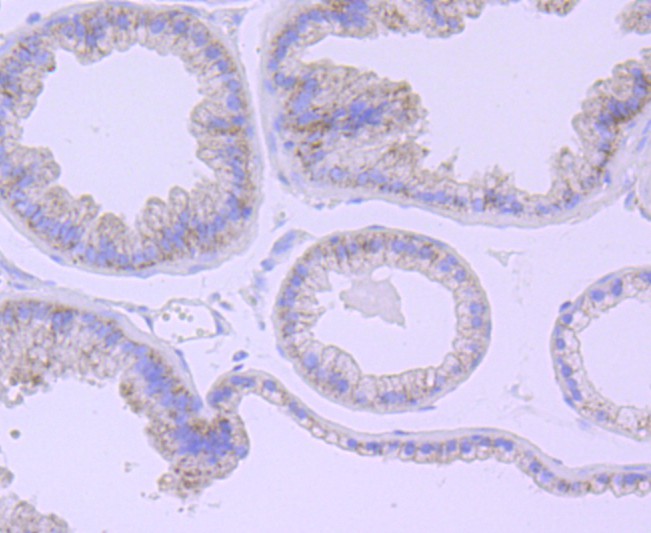 Immunohistochemical analysis of paraffin-embedded mouse prostate tissue using anti-Catalase antibody. The section was pre-treated using heat mediated antigen retrieval with Tris-EDTA buffer (pH 9.0) for 20 minutes.The tissues were blocked in 1% BSA for 30 minutes at room temperature, washed with ddH2O and PBS, and then probed with the primary antibody (ET1703-31, 1/50) for 30 minutes at room temperature. The detection was performed using an HRP conjugated compact polymer system. DAB was used as the chromogen. Tissues were counterstained with hematoxylin and mounted with DPX.