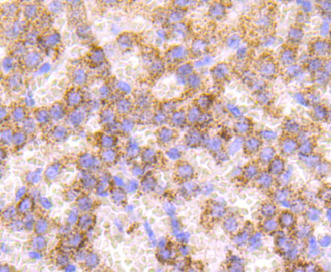 Immunohistochemical analysis of paraffin-embedded rat adrenal gland tissue using anti-Catalase antibody. The section was pre-treated using heat mediated antigen retrieval with Tris-EDTA buffer (pH 9.0) for 20 minutes.The tissues were blocked in 1% BSA for 30 minutes at room temperature, washed with ddH2O and PBS, and then probed with the primary antibody (ET1703-31, 1/50) for 30 minutes at room temperature. The detection was performed using an HRP conjugated compact polymer system. DAB was used as the chromogen. Tissues were counterstained with hematoxylin and mounted with DPX.