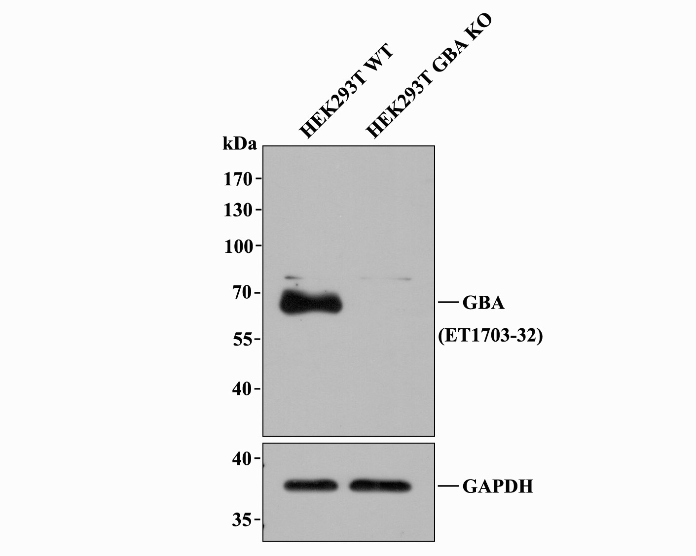 All lanes: Western blot analysis of GBA with anti-GBA antibody [JM10-76] (ET1703-32) at 1:1,000 dilution.<br />
Lane 1: Wild-type HEK293T whole cell lysate (20 µg).<br />
Lane 2: GBA knockout HEK293T whole cell lysate (20 µg).<br />
<br />
ET1703-32 was shown to specifically react with GBA in wild-type HEK293T cells. No band was observed when GBA knockout sample was tested. Wild-type and GBA knockout samples were subjected to SDS-PAGE. Proteins were transferred to a PVDF membrane and blocked with 5% NFDM in TBST for 1 hour at room temperature. The primary antibody (ET1703-32, 1/1,000) and Loading control antibody (Rabbit anti-GAPDH , ET1601-4, 1/10,000) was used in 5% BSA at room temperature for 2 hours. Goat Anti-Rabbit IgG-HRP Secondary Antibody (HA1001) at 1:200,000 dilution was used for 1 hour at room temperature.