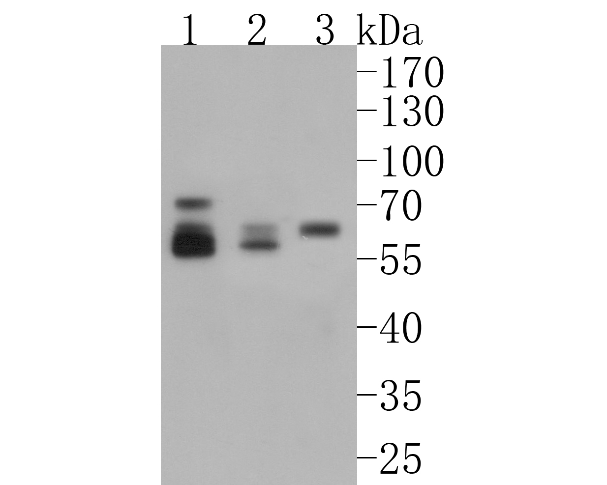 Western blot analysis of GBA on different lysates. Proteins were transferred to a PVDF membrane and blocked with 5% BSA in PBS for 1 hour at room temperature. The primary antibody (ET1703-32, 1/500) was used in 5% BSA at room temperature for 2 hours. Goat Anti-Rabbit IgG - HRP Secondary Antibody (HA1001) at 1:5,000 dilution was used for 1 hour at room temperature.<br />
Positive control: <br />
Lane 1: SK-Br-3 cell lysate<br />
Lane 2: A549 cell lysate<br />
Lane 3: MCF-7 cell lysate