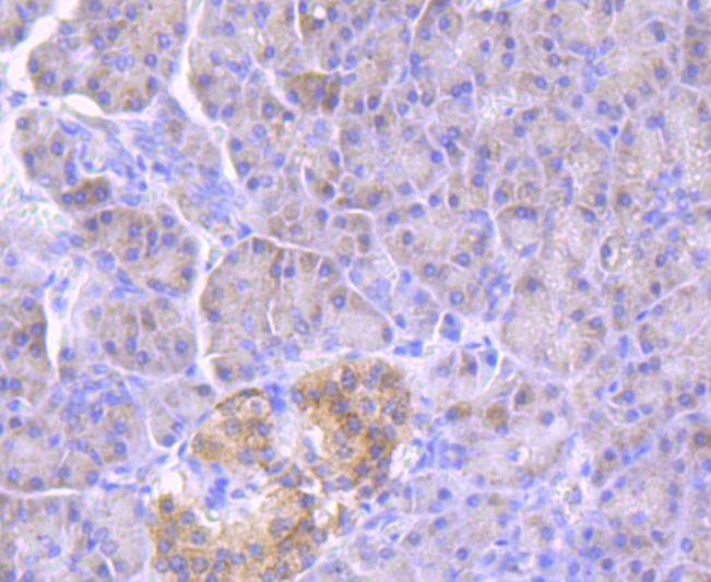 Immunohistochemical analysis of paraffin-embedded human pancreas tissue using anti-GBA antibody. The section was pre-treated using heat mediated antigen retrieval with Tris-EDTA buffer (pH 8.0-8.4) for 20 minutes.The tissues were blocked in 5% BSA for 30 minutes at room temperature, washed with ddH2O and PBS, and then probed with the primary antibody (ET1703-32, 1/50) for 30 minutes at room temperature. The detection was performed using an HRP conjugated compact polymer system. DAB was used as the chromogen. Tissues were counterstained with hematoxylin and mounted with DPX.