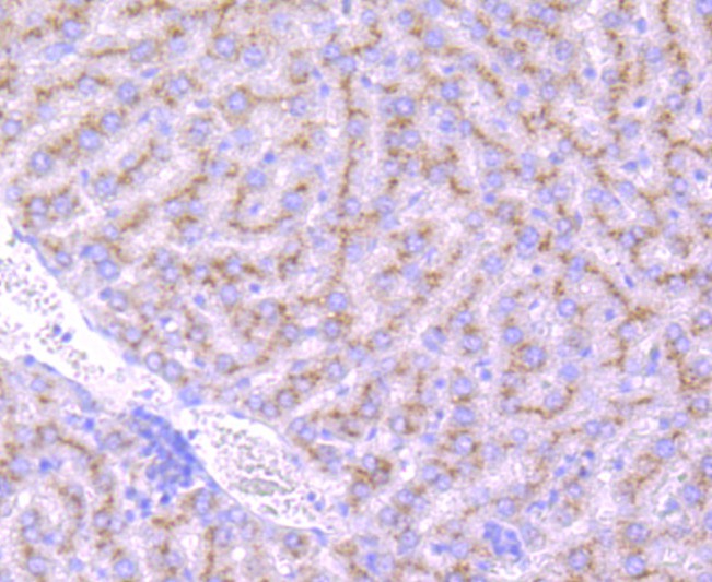 Immunohistochemical analysis of paraffin-embedded rat liver tissue using anti-GBA antibody. The section was pre-treated using heat mediated antigen retrieval with Tris-EDTA buffer (pH 8.0-8.4) for 20 minutes.The tissues were blocked in 5% BSA for 30 minutes at room temperature, washed with ddH2O and PBS, and then probed with the primary antibody (ET1703-32, 1/50) for 30 minutes at room temperature. The detection was performed using an HRP conjugated compact polymer system. DAB was used as the chromogen. Tissues were counterstained with hematoxylin and mounted with DPX.