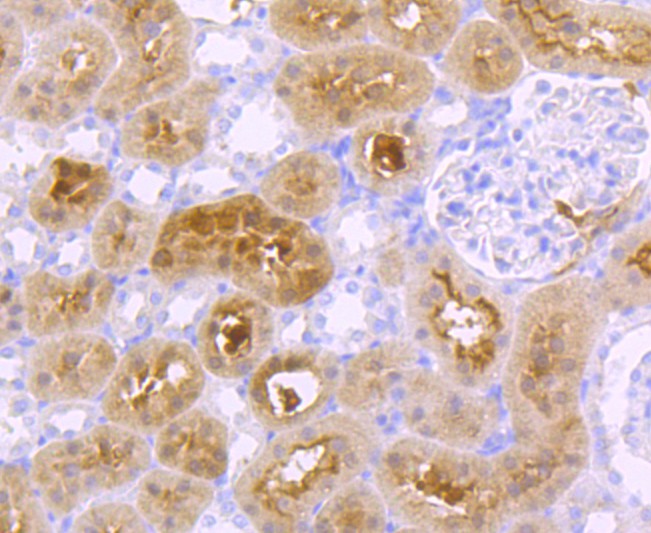 Immunohistochemical analysis of paraffin-embedded rat kidney tissue using anti-GBA antibody. The section was pre-treated using heat mediated antigen retrieval with Tris-EDTA buffer (pH 8.0-8.4) for 20 minutes.The tissues were blocked in 5% BSA for 30 minutes at room temperature, washed with ddH2O and PBS, and then probed with the primary antibody (ET1703-32, 1/50) for 30 minutes at room temperature. The detection was performed using an HRP conjugated compact polymer system. DAB was used as the chromogen. Tissues were counterstained with hematoxylin and mounted with DPX.