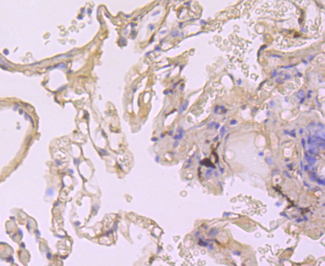 Immunohistochemical analysis of paraffin-embedded human lung tissue using anti-Cyclophilin A antibody. The section was pre-treated using heat mediated antigen retrieval with Tris-EDTA buffer (pH 9.0) for 20 minutes.The tissues were blocked in 1% BSA for 30 minutes at room temperature, washed with ddH2O and PBS, and then probed with the primary antibody (ET1703-33, 1/50) for 30 minutes at room temperature. The detection was performed using an HRP conjugated compact polymer system. DAB was used as the chromogen. Tissues were counterstained with hematoxylin and mounted with DPX.