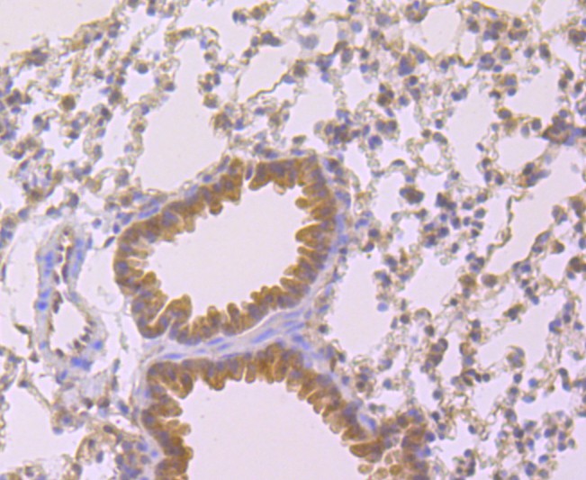 Immunohistochemical analysis of paraffin-embedded mouse lung tissue using anti-Cyclophilin A antibody. The section was pre-treated using heat mediated antigen retrieval with Tris-EDTA buffer (pH 9.0) for 20 minutes.The tissues were blocked in 1% BSA for 30 minutes at room temperature, washed with ddH2O and PBS, and then probed with the primary antibody (ET1703-33, 1/50) for 30 minutes at room temperature. The detection was performed using an HRP conjugated compact polymer system. DAB was used as the chromogen. Tissues were counterstained with hematoxylin and mounted with DPX.