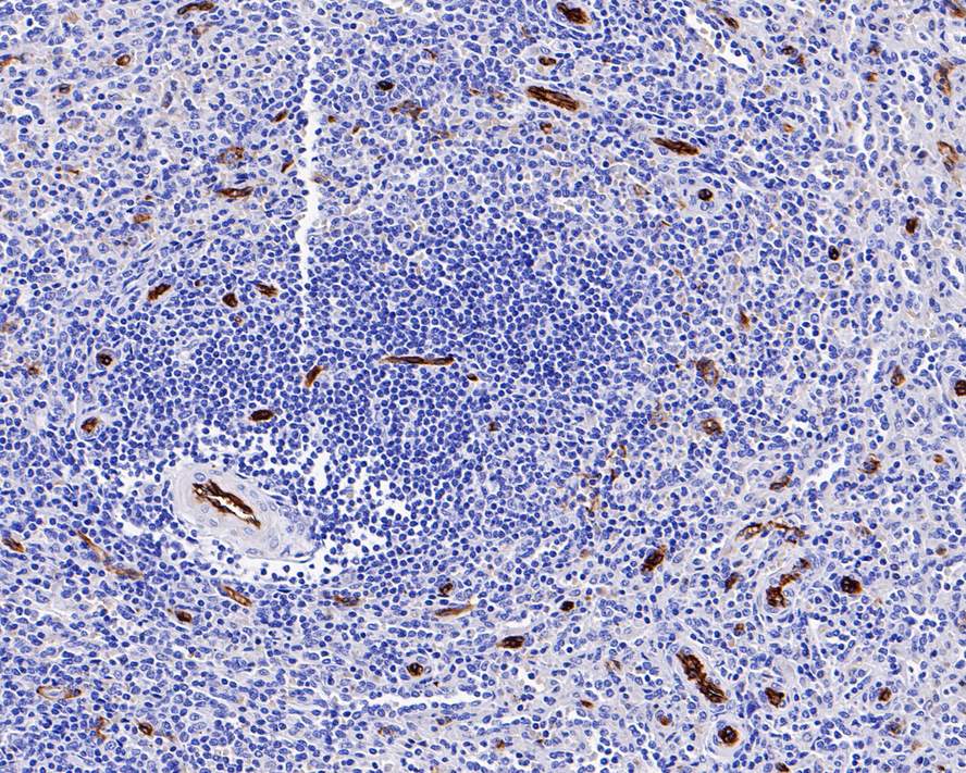 Immunohistochemical analysis of paraffin-embedded human breast tissue using anti-AQP1 antibody. The section was pre-treated using heat mediated antigen retrieval with Tris-EDTA buffer (pH 8.0-8.4) for 20 minutes.The tissues were blocked in 5% BSA for 30 minutes at room temperature, washed with ddH2O and PBS, and then probed with the primary antibody (ET1703-34, 1/50) for 30 minutes at room temperature. The detection was performed using an HRP conjugated compact polymer system. DAB was used as the chromogen. Tissues were counterstained with hematoxylin and mounted with DPX.