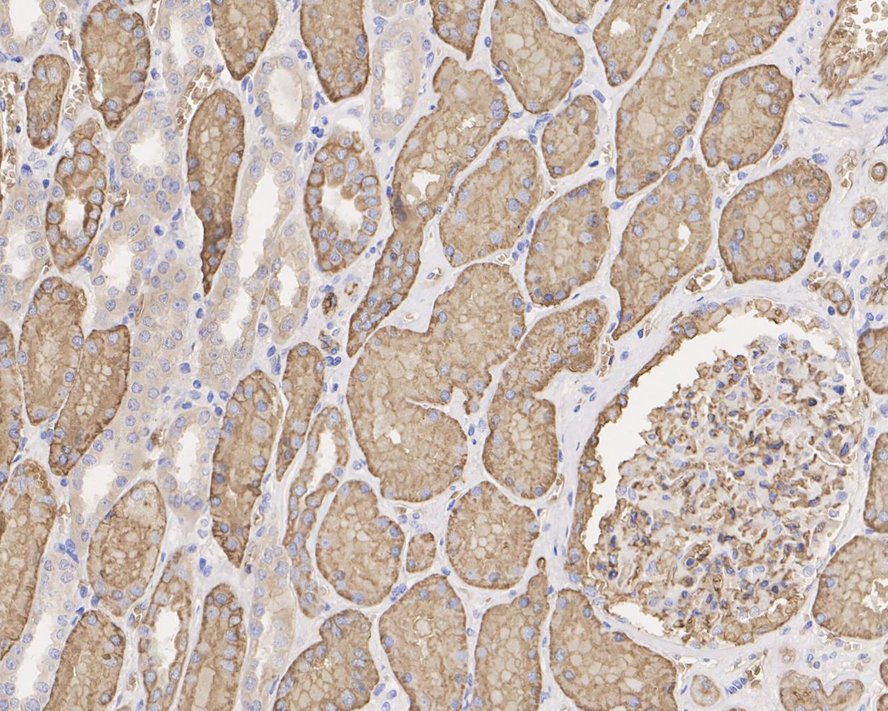 Immunohistochemical analysis of paraffin-embedded human pancreas tissue with Rabbit anti-AQP1 antibody (ET1703-34) at 1/800 dilution.<br />
<br />
The section was pre-treated using heat mediated antigen retrieval with Tris-EDTA buffer (pH 9.0) for 20 minutes. The tissues were blocked in 1% BSA for 20 minutes at room temperature, washed with ddH2O and PBS, and then probed with the primary antibody (ET1703-34) at 1/800 dilution for 1 hour at room temperature. The detection was performed using an HRP conjugated compact polymer system. DAB was used as the chromogen. Tissues were counterstained with hematoxylin and mounted with DPX.