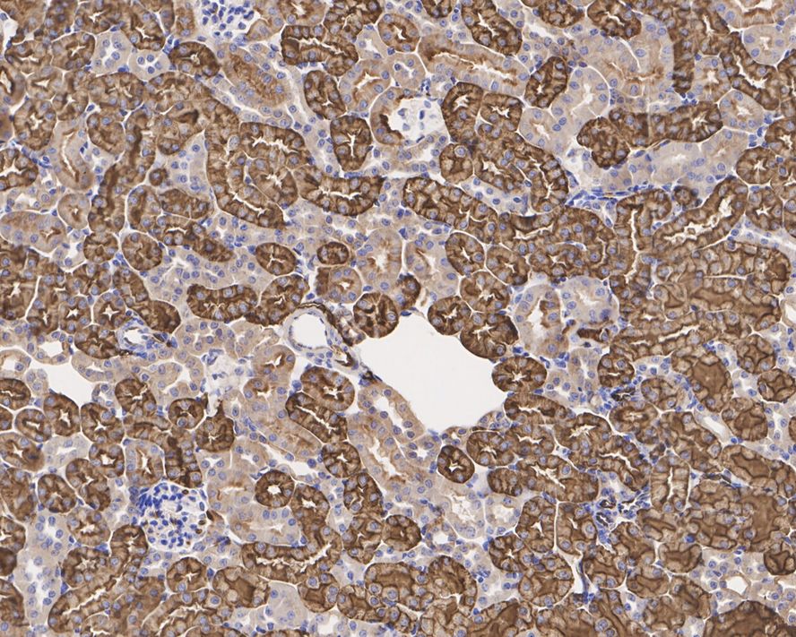 Immunohistochemical analysis of paraffin-embedded mouse skeletal muscle tissue using anti-AQP1 antibody. The section was pre-treated using heat mediated antigen retrieval with Tris-EDTA buffer (pH 8.0-8.4) for 20 minutes.The tissues were blocked in 5% BSA for 30 minutes at room temperature, washed with ddH2O and PBS, and then probed with the primary antibody (ET1703-34, 1/50) for 30 minutes at room temperature. The detection was performed using an HRP conjugated compact polymer system. DAB was used as the chromogen. Tissues were counterstained with hematoxylin and mounted with DPX.