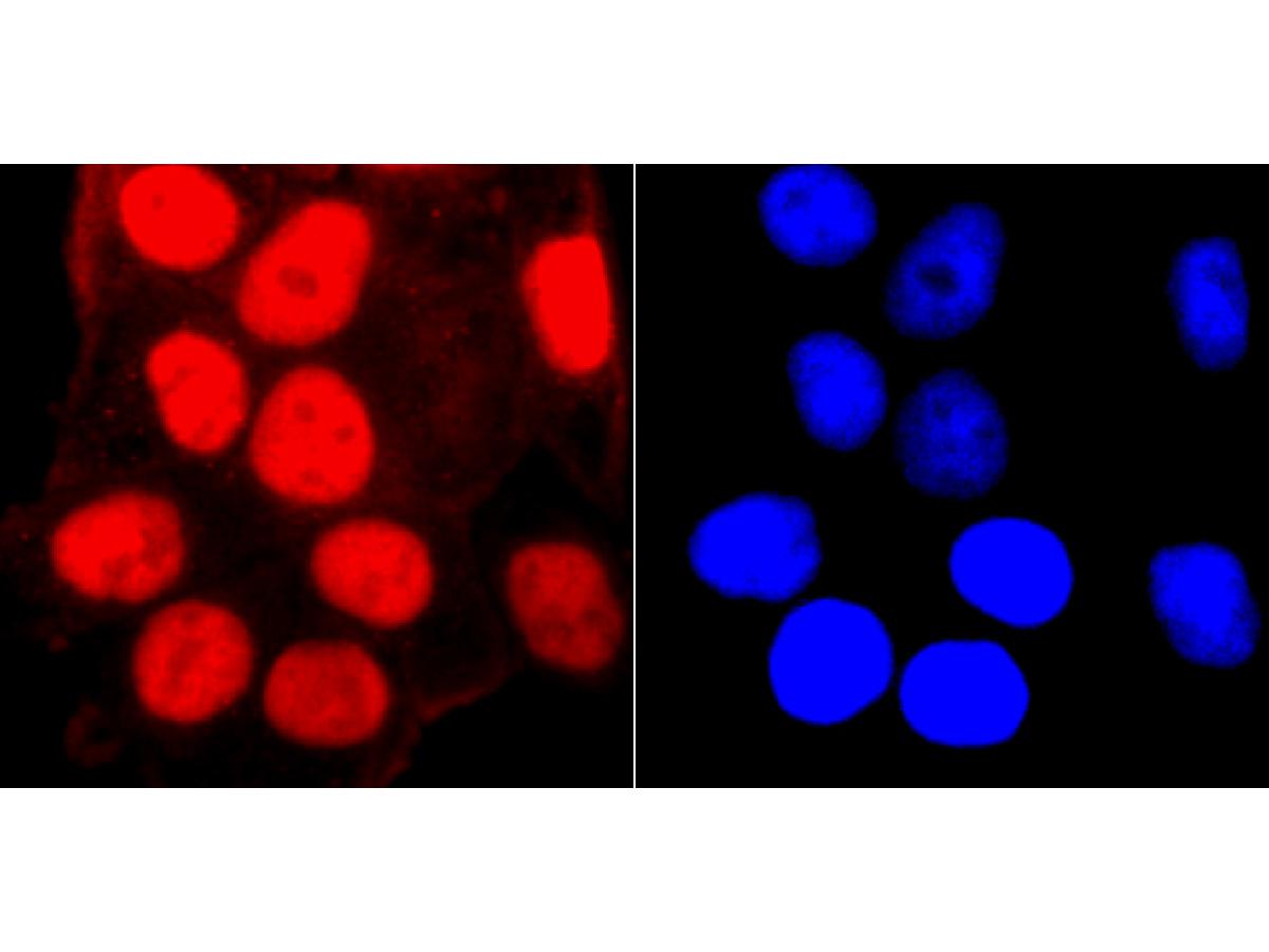 ICC staining SMC3 in Hela cells (red). The nuclear counter stain is DAPI (blue). Cells were fixed in paraformaldehyde, permeabilised with 0.25% Triton X100/PBS.