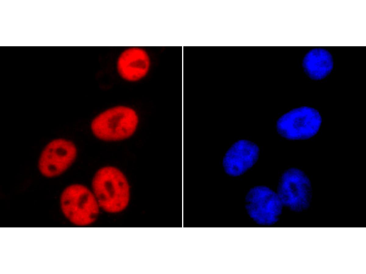 ICC staining SMC3 in HepG2 cells (red). The nuclear counter stain is DAPI (blue). Cells were fixed in paraformaldehyde, permeabilised with 0.25% Triton X100/PBS.