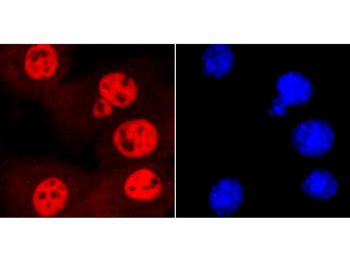 ICC staining SMC3 in NIH-3T3 cells (red). The nuclear counter stain is DAPI (blue). Cells were fixed in paraformaldehyde, permeabilised with 0.25% Triton X100/PBS.