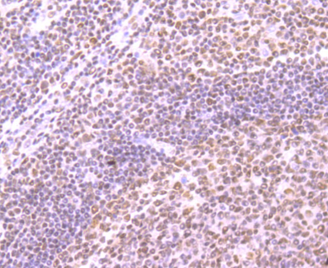 Immunohistochemical analysis of paraffin-embedded human tonsil tissue using anti-SMC3 antibody. Counter stained with hematoxylin.