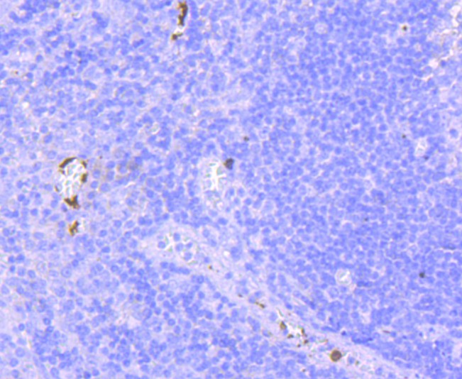 Immunohistochemical analysis of paraffin-embedded human tonsil tissue using anti-CD41 antibody. The section was pre-treated using heat mediated antigen retrieval with Tris-EDTA buffer (pH 9.0) for 20 minutes.The tissues were blocked in 1% BSA for 30 minutes at room temperature, washed with ddH2O and PBS, and then probed with the primary antibody (ET1703-37, 1/50) for 30 minutes at room temperature. The detection was performed using an HRP conjugated compact polymer system. DAB was used as the chromogen. Tissues were counterstained with hematoxylin and mounted with DPX.