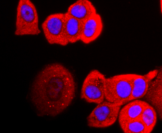 ICC staining of Perilipin A in MCF-7 cells (red). Formalin fixed cells were permeabilized with 0.1% Triton X-100 in TBS for 10 minutes at room temperature and blocked with 1% Blocker BSA for 15 minutes at room temperature. Cells were probed with the primary antibody (ET1703-38, 1/50) for 1 hour at room temperature, washed with PBS. Alexa Fluor®594 Goat anti-Rabbit IgG was used as the secondary antibody at 1/1,000 dilution. The nuclear counter stain is DAPI (blue).