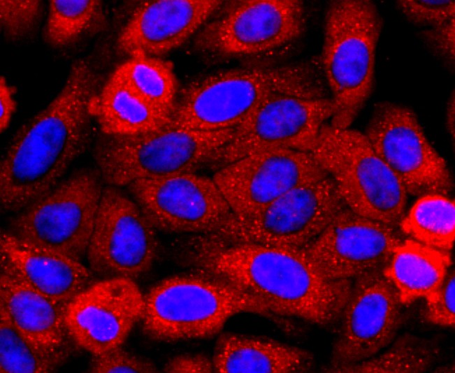 ICC staining of Perilipin A in HepG2 cells (red). Formalin fixed cells were permeabilized with 0.1% Triton X-100 in TBS for 10 minutes at room temperature and blocked with 1% Blocker BSA for 15 minutes at room temperature. Cells were probed with the primary antibody (ET1703-38, 1/50) for 1 hour at room temperature, washed with PBS. Alexa Fluor®594 Goat anti-Rabbit IgG was used as the secondary antibody at 1/1,000 dilution. The nuclear counter stain is DAPI (blue).