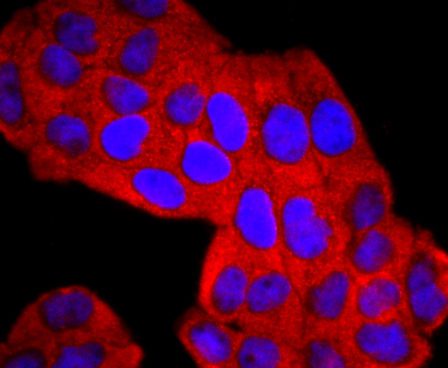 ICC staining of Lipocalin-2 in Hela cells (red). Formalin fixed cells were permeabilized with 0.1% Triton X-100 in TBS for 10 minutes at room temperature and blocked with 10% negative goat serum for 15 minutes at room temperature. Cells were probed with the primary antibody (ET1703-39, 1/50) for 1 hour at room temperature, washed with PBS. Alexa Fluor®594 conjugate-Goat anti-Rabbit IgG was used as the secondary antibody at 1/1,000 dilution. The nuclear counter stain is DAPI (blue).