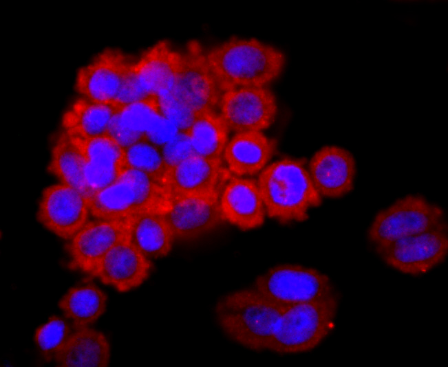 ICC staining of Lipocalin-2 in SW480 cells (red). Formalin fixed cells were permeabilized with 0.1% Triton X-100 in TBS for 10 minutes at room temperature and blocked with 10% negative goat serum for 15 minutes at room temperature. Cells were probed with the primary antibody (ET1703-39, 1/50) for 1 hour at room temperature, washed with PBS. Alexa Fluor®594 conjugate-Goat anti-Rabbit IgG was used as the secondary antibody at 1/1,000 dilution. The nuclear counter stain is DAPI (blue).