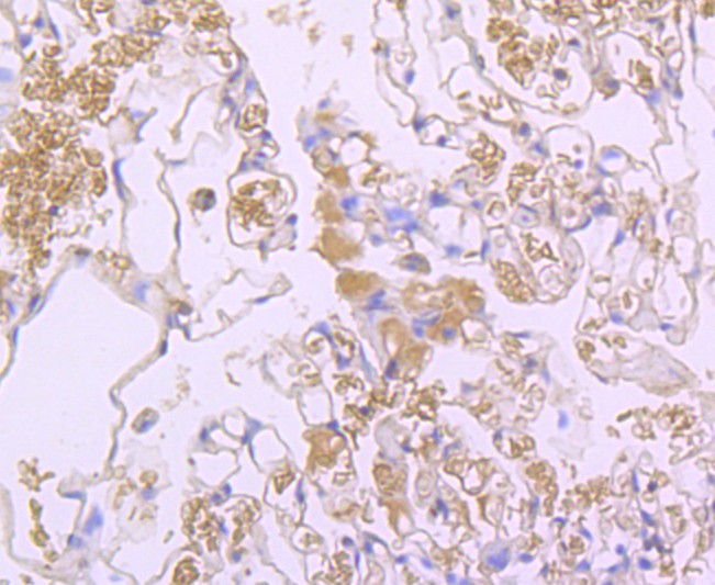Immunohistochemical analysis of paraffin-embedded human lung tissue using anti-Lipocalin-2 antibody. The section was pre-treated using heat mediated antigen retrieval with Tris-EDTA buffer (pH 9.0) for 20 minutes.The tissues were blocked in 1% BSA for 30 minutes at room temperature, washed with ddH2O and PBS, and then probed with the primary antibody (ET1703-39, 1/50) for 30 minutes at room temperature. The detection was performed using an HRP conjugated compact polymer system. DAB was used as the chromogen. Tissues were counterstained with hematoxylin and mounted with DPX.
