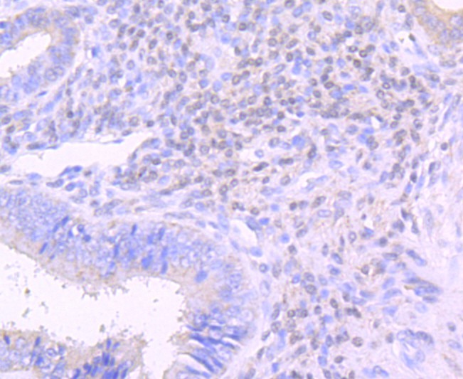 Immunohistochemical analysis of paraffin-embedded human uterus tissue using anti-Lipocalin-2 antibody. The section was pre-treated using heat mediated antigen retrieval with Tris-EDTA buffer (pH 9.0) for 20 minutes.The tissues were blocked in 1% BSA for 30 minutes at room temperature, washed with ddH2O and PBS, and then probed with the primary antibody (ET1703-39, 1/50) for 30 minutes at room temperature. The detection was performed using an HRP conjugated compact polymer system. DAB was used as the chromogen. Tissues were counterstained with hematoxylin and mounted with DPX.