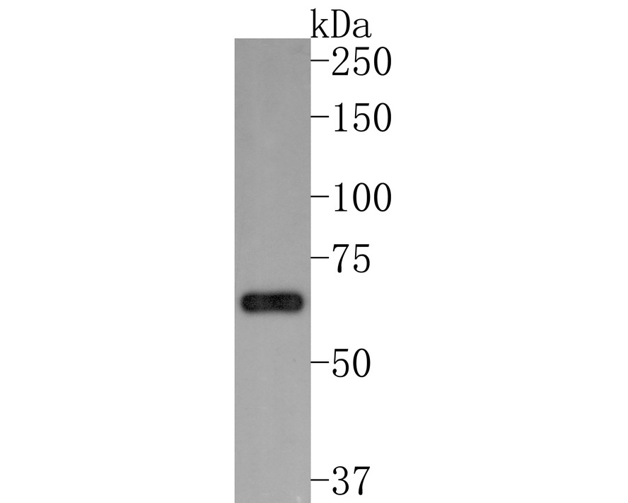 Western blot analysis of SDHA on HepG2 cell lysates. Proteins were transferred to a PVDF membrane and blocked with 5% BSA in PBS for 1 hour at room temperature. The primary antibody (ET1703-40, 1/500) was used in 5% BSA at room temperature for 2 hours. Goat Anti-Rabbit IgG - HRP Secondary Antibody (HA1001) at 1:200,000 dilution was used for 1 hour at room temperature.<br />
<br />
Predicted band size: 73 kDa<br />
Observed band size: 60 kDa