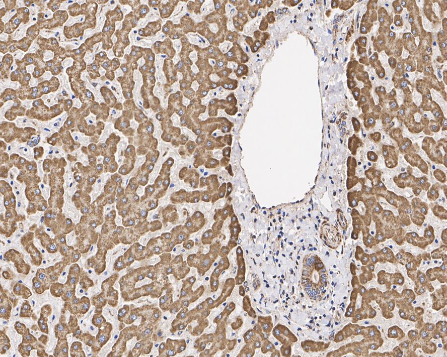 Immunohistochemical analysis of paraffin-embedded mouse testis tissue using anti-SDHA antibody. The section was pre-treated using heat mediated antigen retrieval with Tris-EDTA buffer (pH 9.0) for 20 minutes.The tissues were blocked in 1% BSA for 30 minutes at room temperature, washed with ddH2O and PBS, and then probed with the primary antibody (ET1703-40, 1/50) for 30 minutes at room temperature. The detection was performed using an HRP conjugated compact polymer system. DAB was used as the chromogen. Tissues were counterstained with hematoxylin and mounted with DPX.