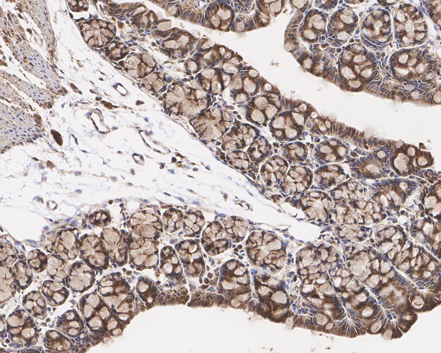 Immunohistochemical analysis of paraffin-embedded mouse skeletal muscle tissue using anti-SDHA antibody. The section was pre-treated using heat mediated antigen retrieval with Tris-EDTA buffer (pH 9.0) for 20 minutes.The tissues were blocked in 1% BSA for 30 minutes at room temperature, washed with ddH2O and PBS, and then probed with the primary antibody (ET1703-40, 1/50) for 30 minutes at room temperature. The detection was performed using an HRP conjugated compact polymer system. DAB was used as the chromogen. Tissues were counterstained with hematoxylin and mounted with DPX.