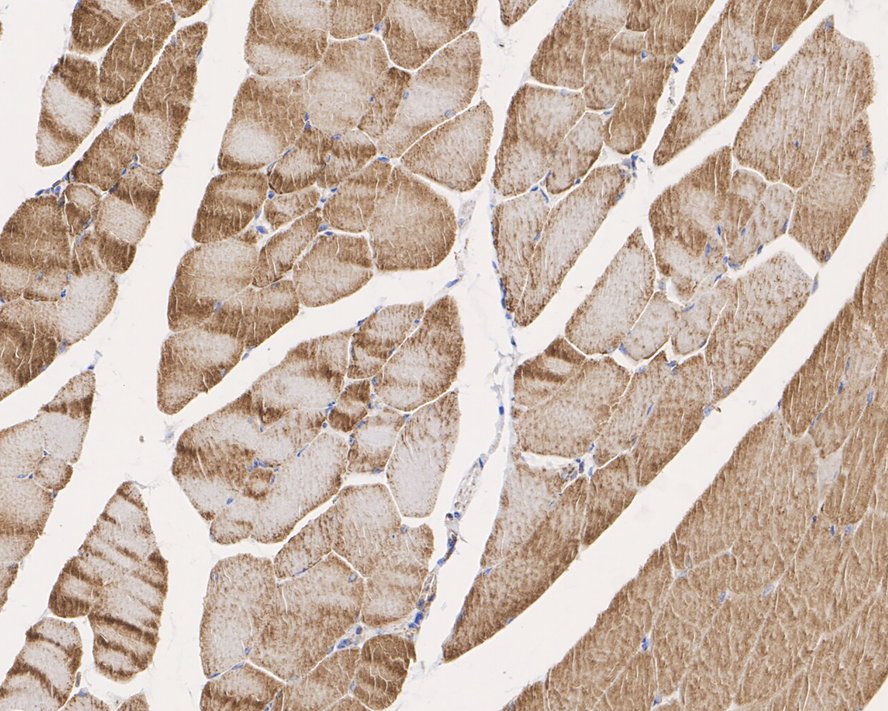 Immunohistochemical analysis of paraffin-embedded mouse colon tissue using anti-SDHA antibody. The section was pre-treated using heat mediated antigen retrieval with Tris-EDTA buffer (pH 9.0) for 20 minutes.The tissues were blocked in 1% BSA for 30 minutes at room temperature, washed with ddH2O and PBS, and then probed with the primary antibody (ET1703-40, 1/50) for 30 minutes at room temperature. The detection was performed using an HRP conjugated compact polymer system. DAB was used as the chromogen. Tissues were counterstained with hematoxylin and mounted with DPX.