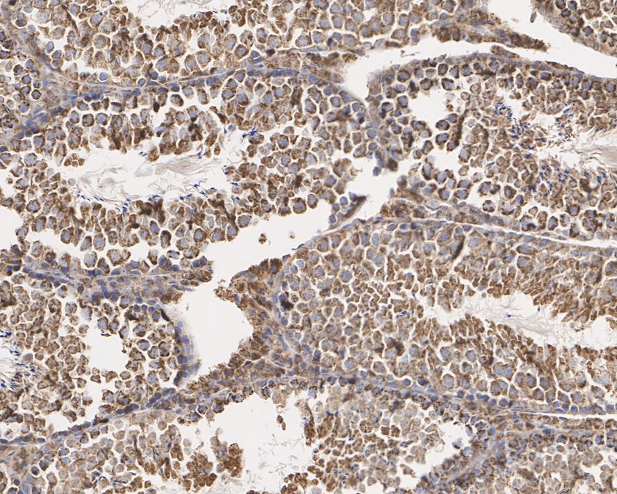 Immunohistochemical analysis of paraffin-embedded zebrafish tissue using anti-SDHA antibody. The section was pre-treated using heat mediated antigen retrieval with Tris-EDTA buffer (pH 9.0) for 20 minutes.The tissues were blocked in 1% BSA for 30 minutes at room temperature, washed with ddH2O and PBS, and then probed with the primary antibody (ET1703-40, 1/50) for 30 minutes at room temperature. The detection was performed using an HRP conjugated compact polymer system. DAB was used as the chromogen. Tissues were counterstained with hematoxylin and mounted with DPX.