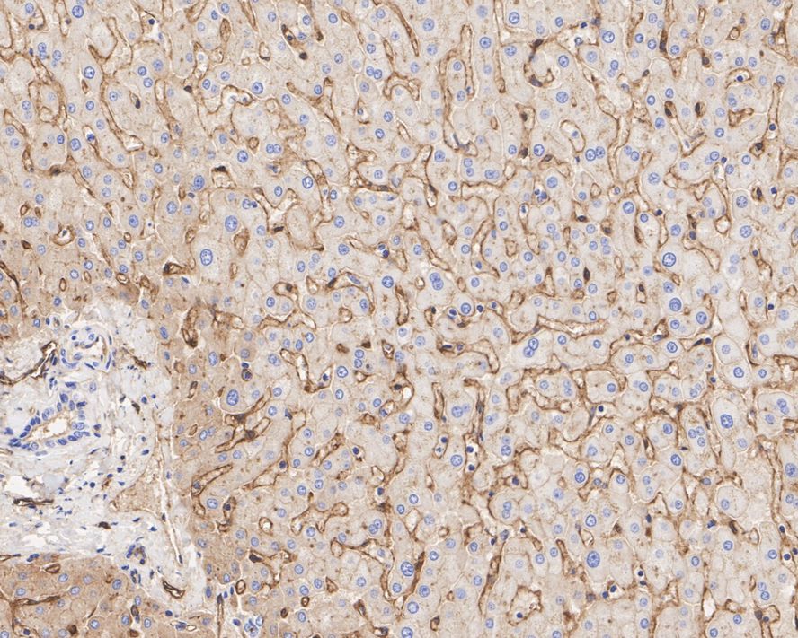 Immunohistochemical analysis of paraffin-embedded human tonsil tissue using anti-CD73 antibody. The section was pre-treated using heat mediated antigen retrieval with Tris-EDTA buffer (pH 8.0-8.4) for 20 minutes.The tissues were blocked in 5% BSA for 30 minutes at room temperature, washed with ddH2O and PBS, and then probed with the primary antibody (ET1703-41, 1/50) for 30 minutes at room temperature. The detection was performed using an HRP conjugated compact polymer system. DAB was used as the chromogen. Tissues were counterstained with hematoxylin and mounted with DPX.